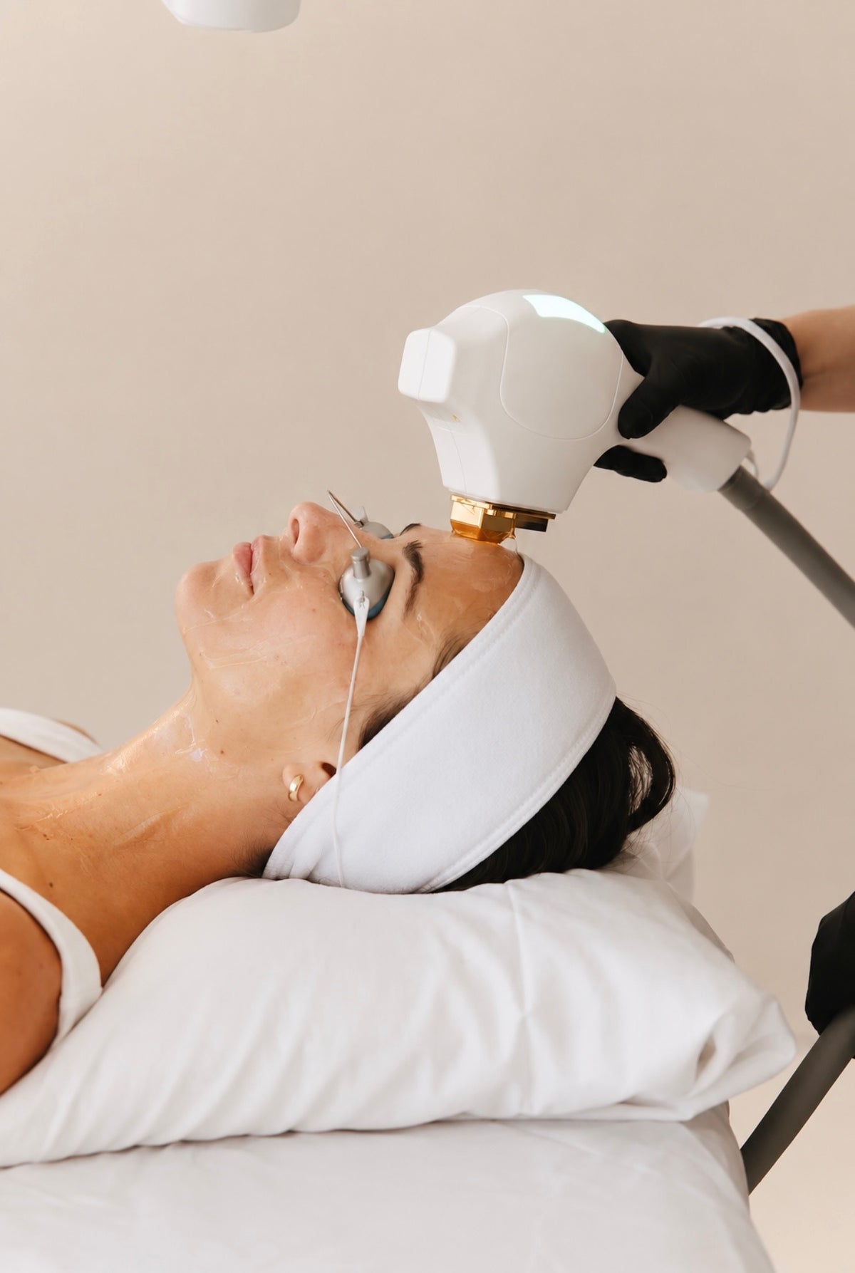 IPL Facial | Luz Pulsada Intensa