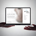 Acne Scars: An Immunological and Functional Approach to Cutaneous Tissue

Clinical Foundations for Effective Intervention