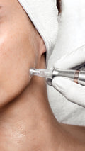 Dermapen